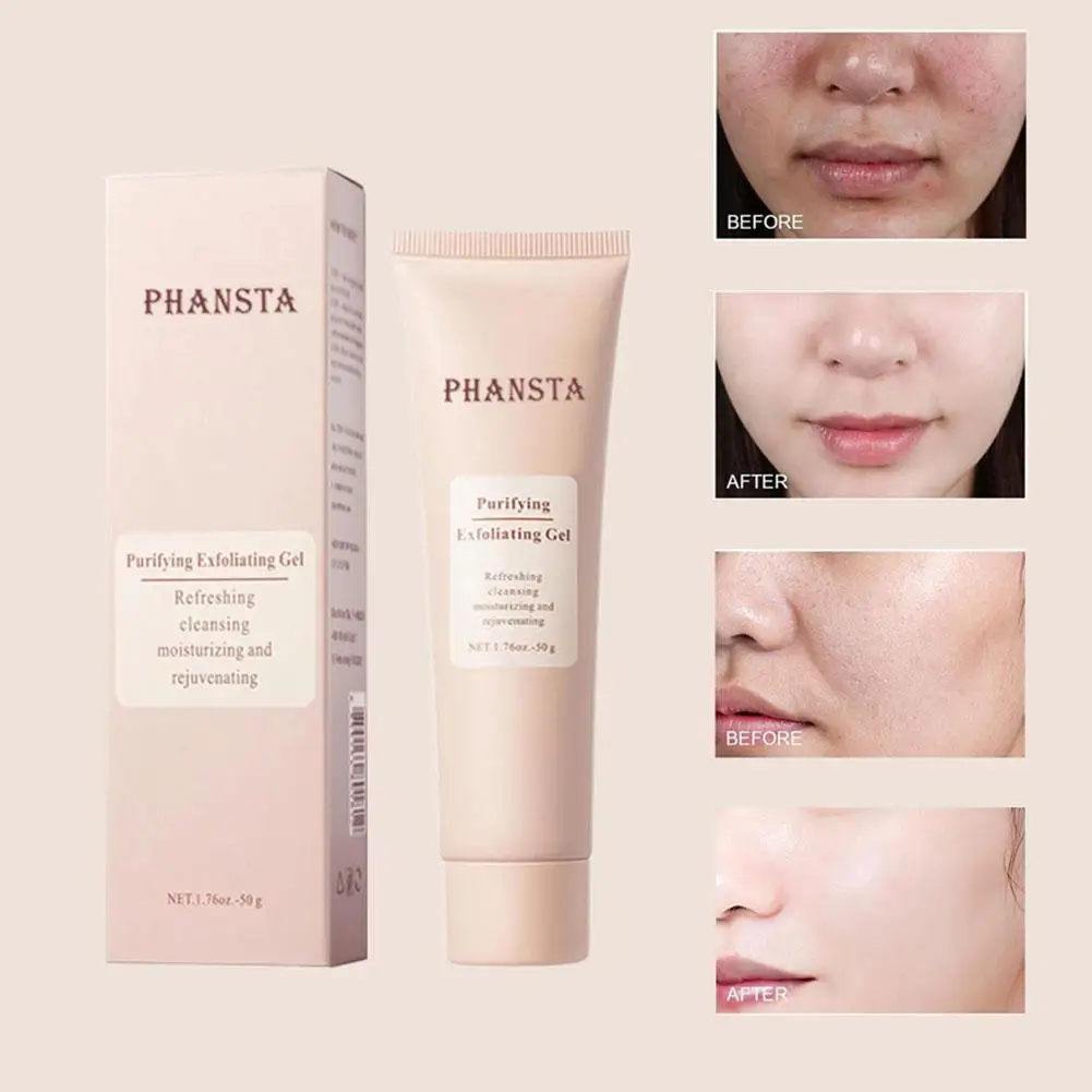 PHANSTA Peeling-Gel, entfernt abgestorbene Hautschüppchen und Gesichts-Keratin, reinigt die Poren, kontrolliert die Ölproduktion, sanfte Reinigung, Gesichtspflege