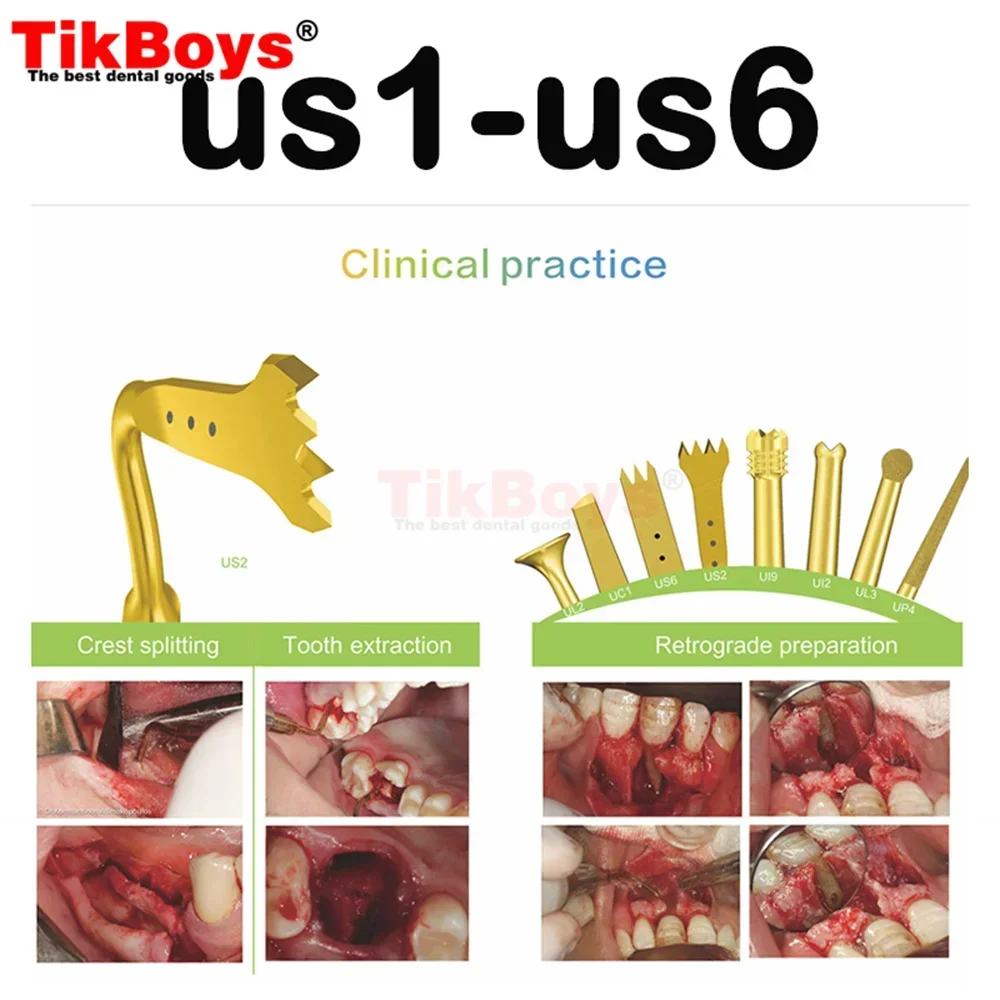 US1 Piezosurgery Osteotomy Bone Cutting Dental Surgery Tips US1L US1R US2 US3 US4 US5 US6 US7 US11 US12 for Mectron Woodpecker