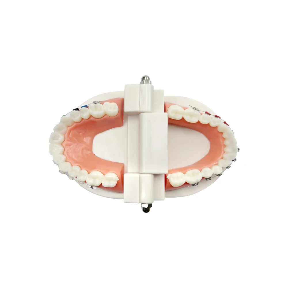 1 Pcs Dental Orthodontic Treatment Tooth Model With Ceramic Metal 1/4 Self-Ligating Brackets For Dentist-Patient Communication