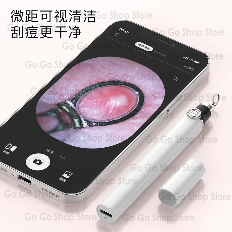 Smart Pore Cleaner Visual Electric Acne Needle Squeeze Acne Household Beauty Instrument Cleansing Facial Cleansing