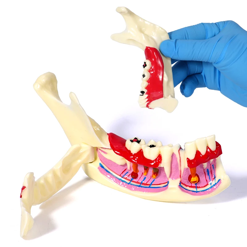 

1 шт., модель стоматологического эндодонтического лечения, анатомия десен, стоматология, исследование, уход за полостью рта, модель зубов, анатомическая модель