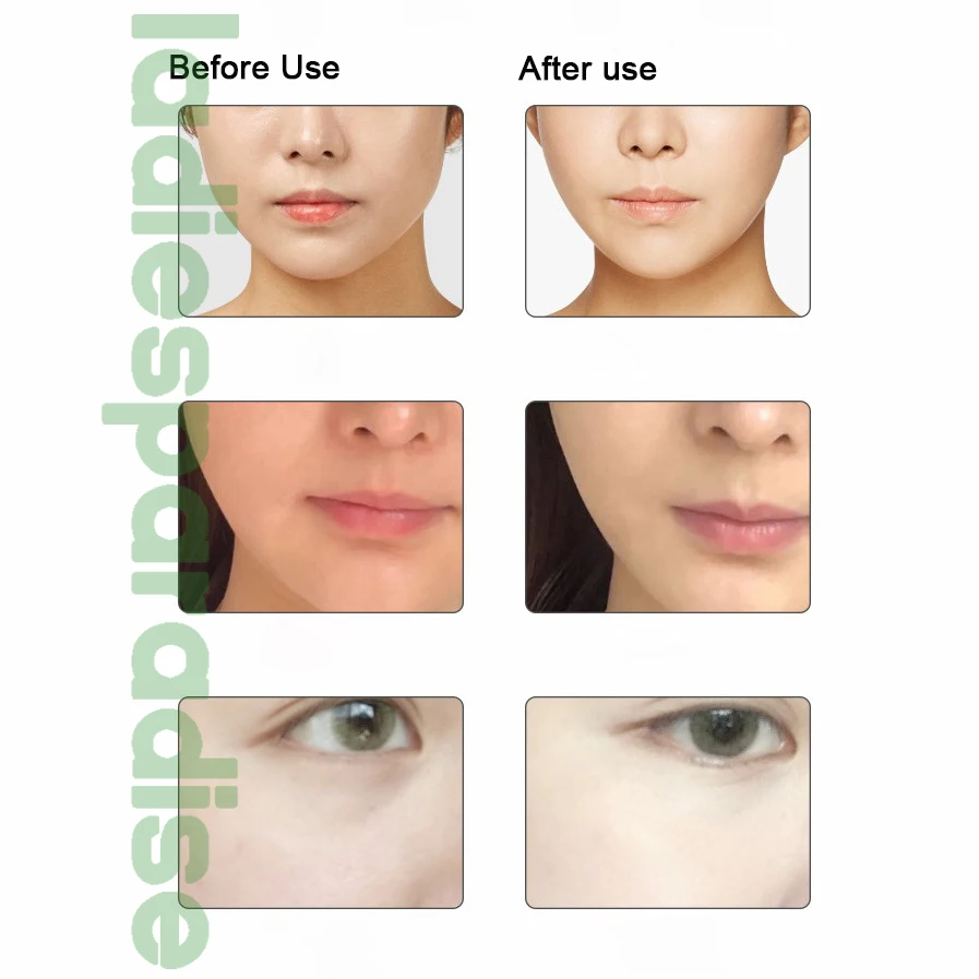 Instrumento facial anti-rugas da beleza da casa do levantamento da pele da microcorrente, B-2022