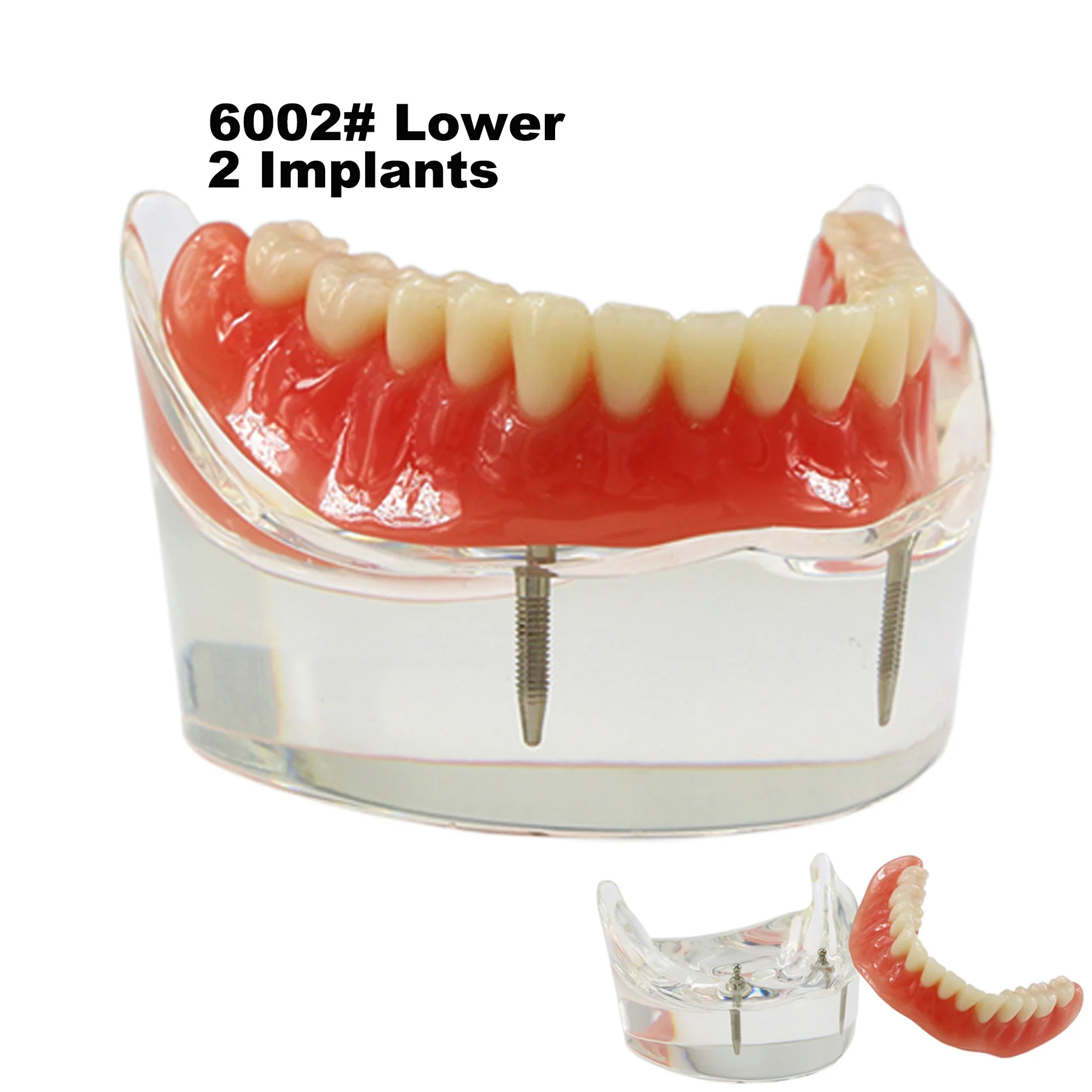 Implant dentystyczny Typodont Model zębów Overdenture 2 4 implanty Superior górna dolna gorsza przywrócenie Demo do nauki