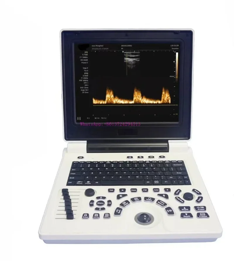 Direct factory sales XF P20 Ultrasound Scanner Veterinary Machine Laptop 12 Inch Portable Black White with Micro convex probe