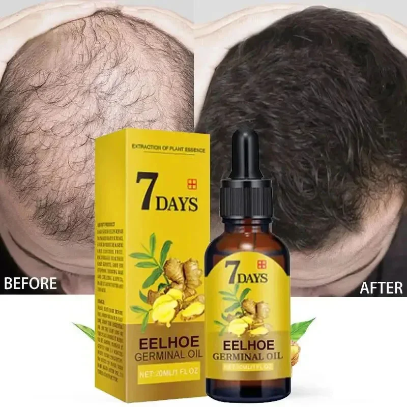 

7 Days Fast Ginger Hair Growth Serum Anti-loss Hair Regrowth Essential Oil Repair Damaged Hair Roots Hair Care For Women Men