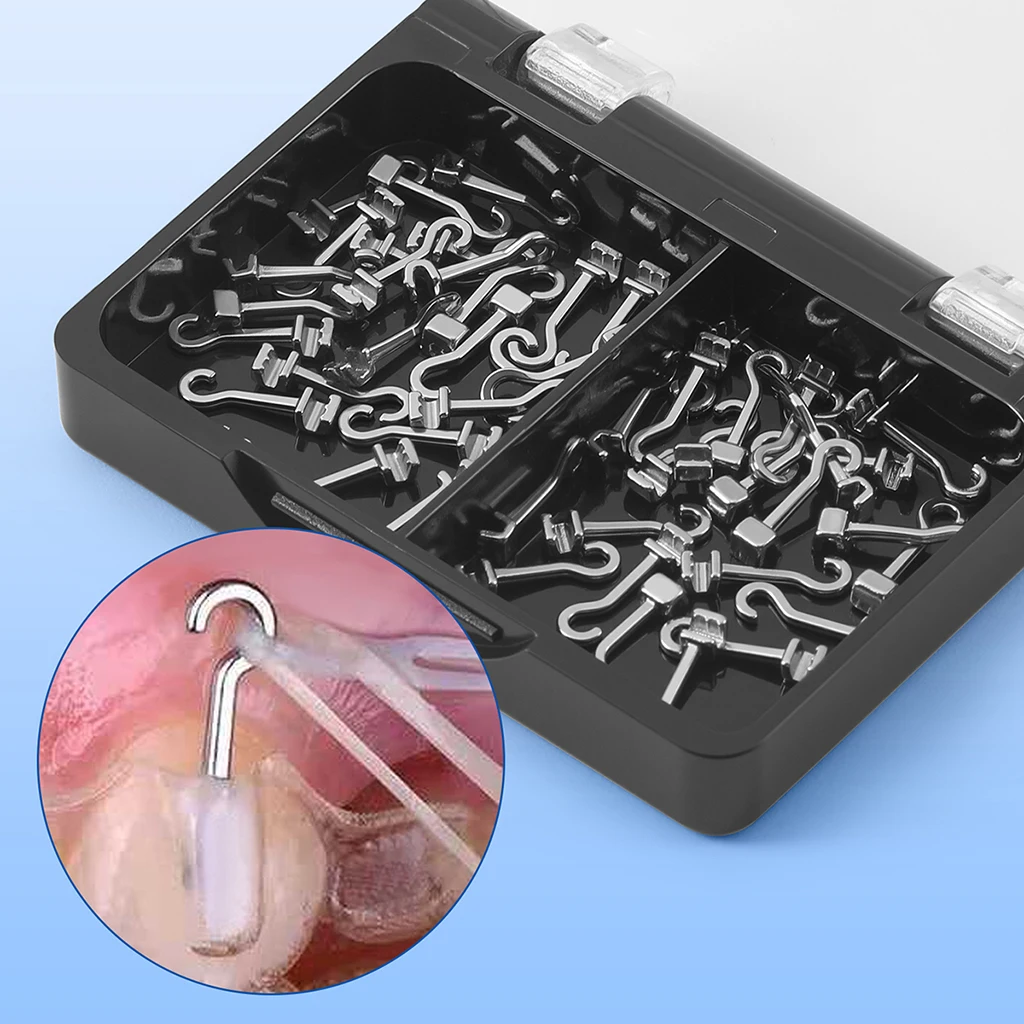50 Stück/Box AZDENT Dental Kieferorthopädische Gleitende Crimpbare Haken Lang Rechts/Links Gebogene Crimpbare Haken 2,1/3,1/5,4mm Passend für Drahtbögen – Detail 9