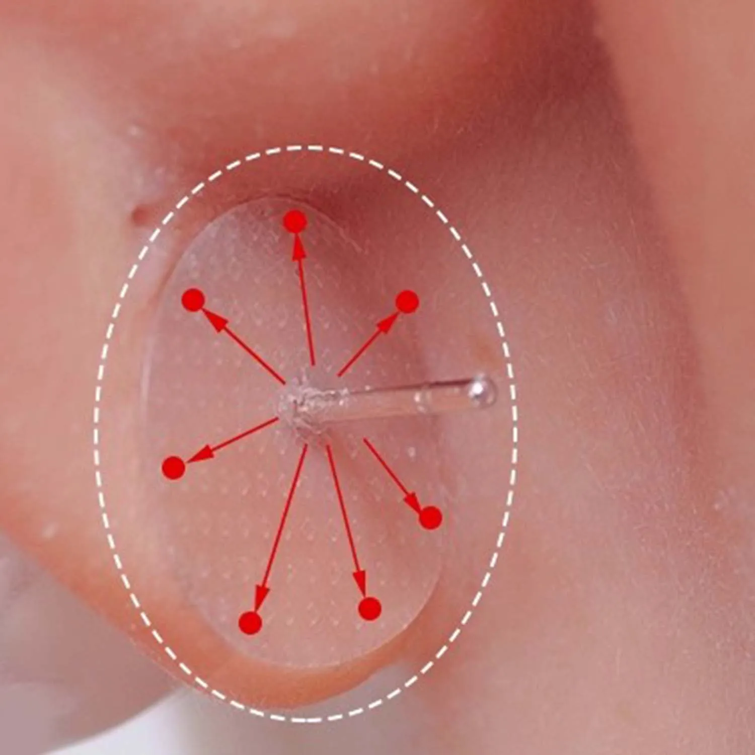 1000 قطعة من ملصقات الأذن الواقية غير المرئية للأقراط الممتدة لردهات الأذن وتخفيف الضغط من الأقراط الثقيلة