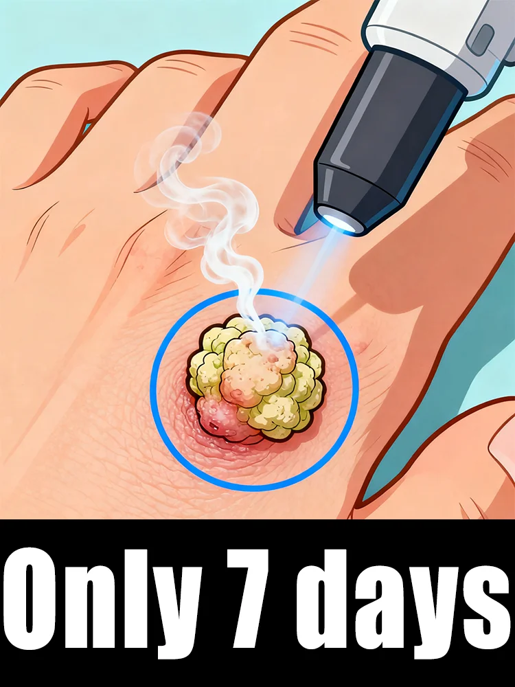 

Gᴇɴᴇʀᴀᴛɪᴏɴ-2 Lᴀsᴇʀ Sᴀʏs Gᴏᴏᴅʙʏᴇ Tᴏ ᴀʟʟ ᴡᴀʀᴛs Iɴ 7 Dᴀʏs