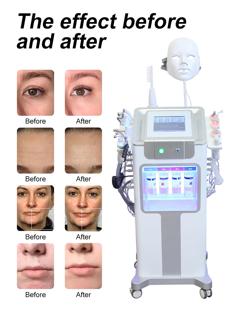AOKO Neue 12 IN 1 Hydro Dermabrasion Aqua Peeling Ultraschall Gesichtspflege Sauerstoff Injektion Hautverjüngung Wittling Schönheitsmaschine – Detail 2