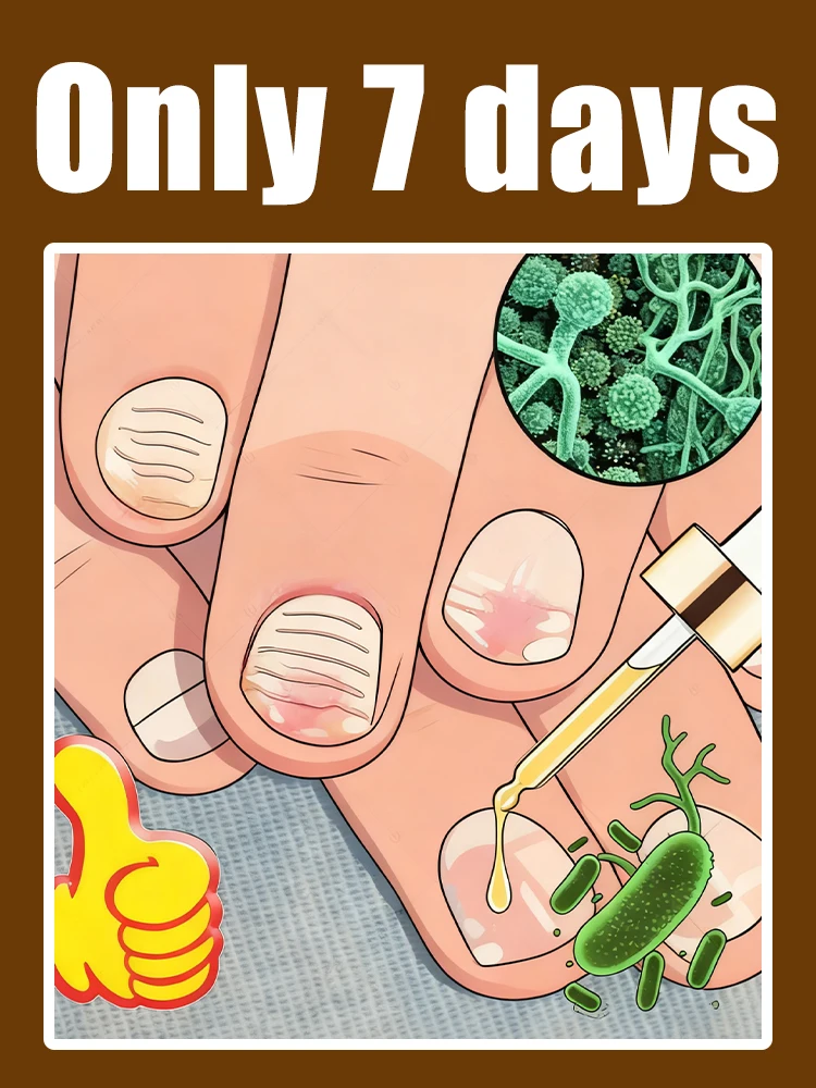 Intervene early to maintain foot health ᵃⁿᵈ ˢᵃʸ ᵍᵒᵒᵈᵇʸᵉ ᵗᵒ ʳᵉᶜᵘʳʳⁱⁿᵍ ᵗʳᵒᵘᵇˡᵉˢ