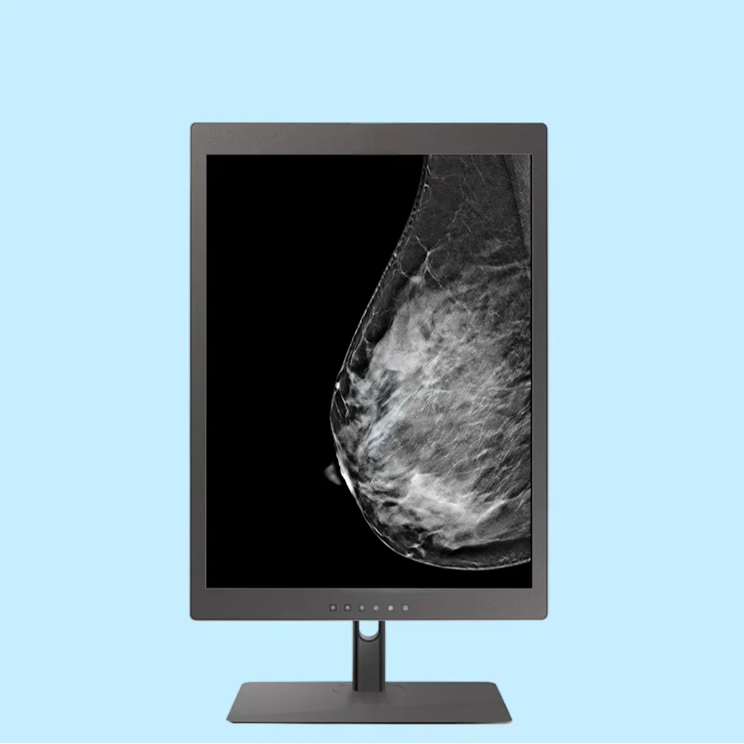 Vet Human Medical Display Manufacturer DICOM Mammo Color Grayscale Mammography Diagnostic Breast Medical Monitor