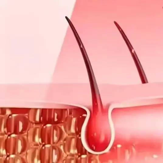 Infrared Red Light Therapy Cap 208 Diodes Wireless LLLT Laser for Thin Hair Regrowth