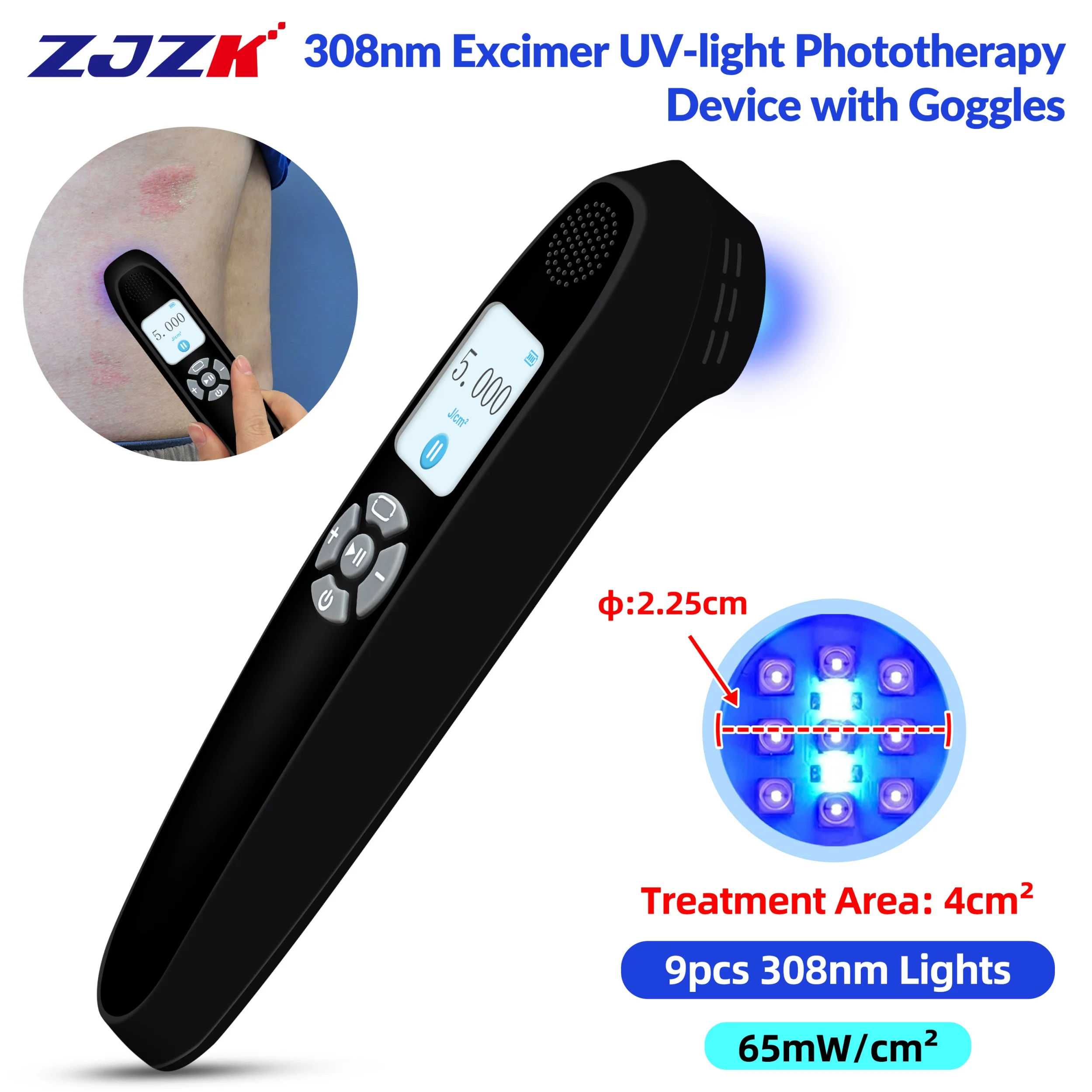 

Portable 308nm Excimer UVB Light Laser Pen UV Therapy for Marking Covering Traitement of Vitiligo and Psoriasis