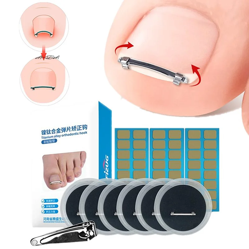 Abrazadera curva para uñas encarnadas, herramienta de pedicura para el cuidado de las uñas de los pies, Clip de corrección alisador, herramienta de cuidado de uñas integrada para dedos de los pies