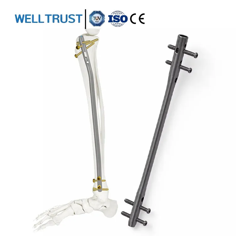 Well Trust Tibial Interlocking Nail Intramedullary Cannulated Orthopedic Implant Kit CE Certified For Orthopedic Surgery