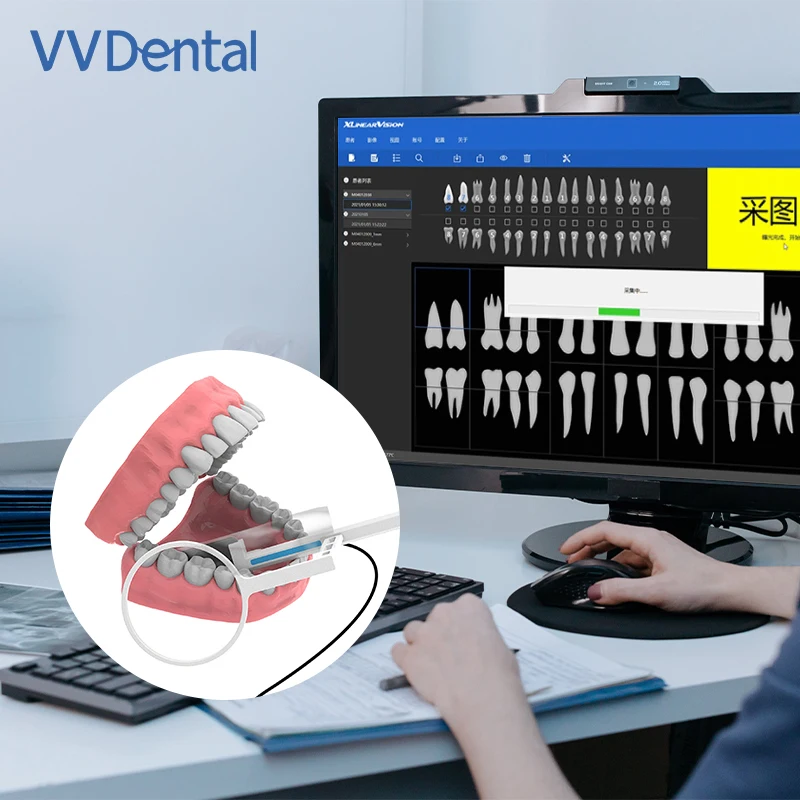 Portable X-ray Dental Xray Intraoral Rvg Imaging System Digital Sensor X Ray For Dentists Oral Care Tooth Cleaning