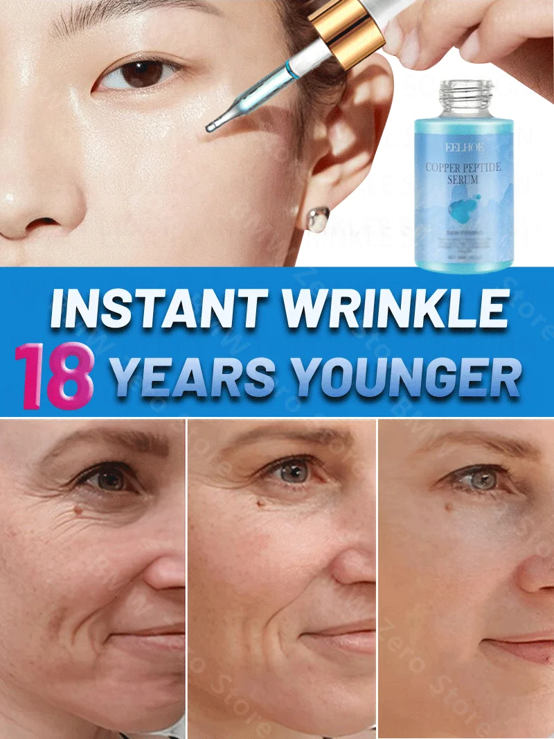 

Eliminate Neck Lines