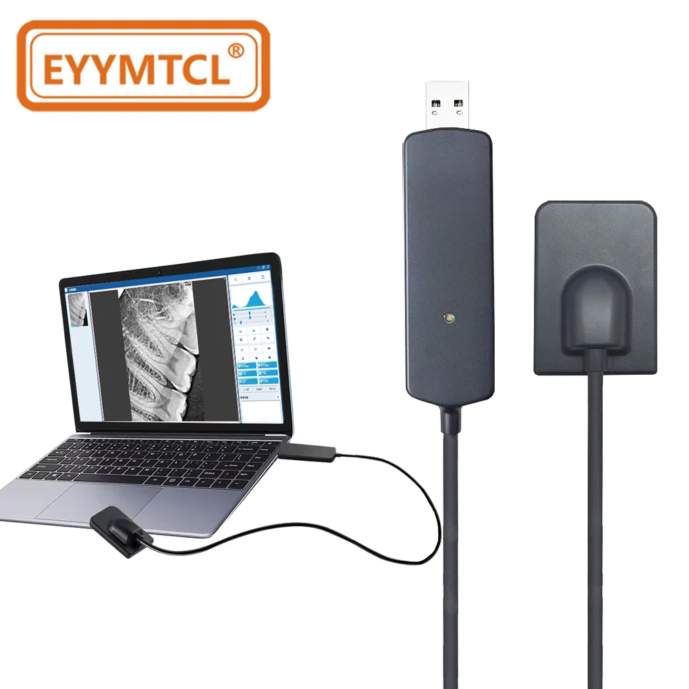 EYY Dental Sensor RX Digital Intraoral Imaging System HD Image Radiovisografo DynImage X-ray Oral Sensor Dental Image Equipment