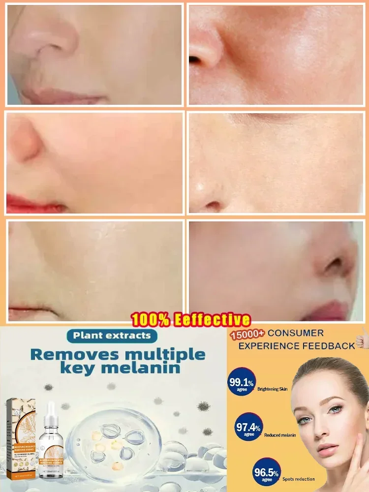 Anti-Freckles Whitening Lightening Serum Age Spots Chloasma Hydration Beautifying Moisturizing Facial Essence