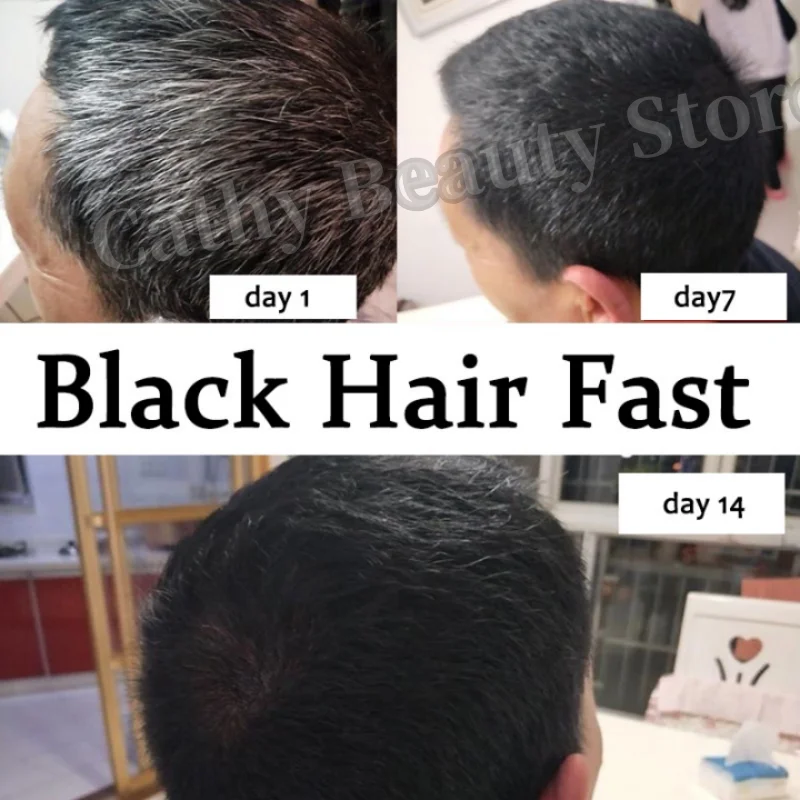 Gray White Hair Treatment Serum Cover White Hair To Black Repair Natural Color Spray Anti Loss Hair Nourish Products Men Women