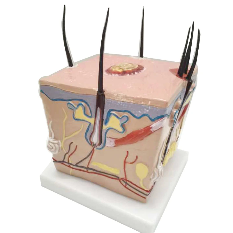 Scalp model hair loss hair transplant hair follicle inflammation capillary nerve teaching model