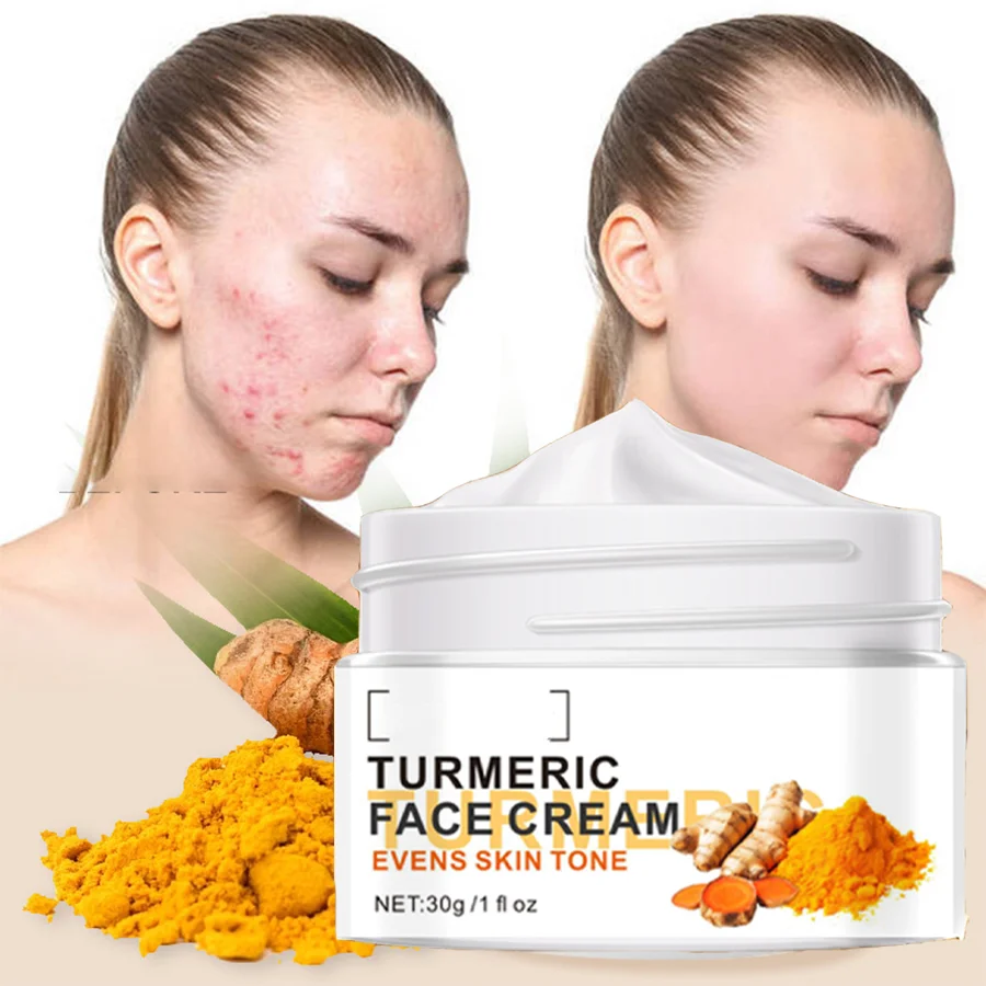 

1 Box Turmeric Glutathione Face Cream Glutathione Whitening Face Cream Reduce Dark Spots Face Whitening Cream
