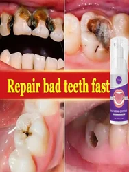 Quick Repair of Cavities Caries Reduce of Plaque Stains Decay Whitening Yellowing Repair