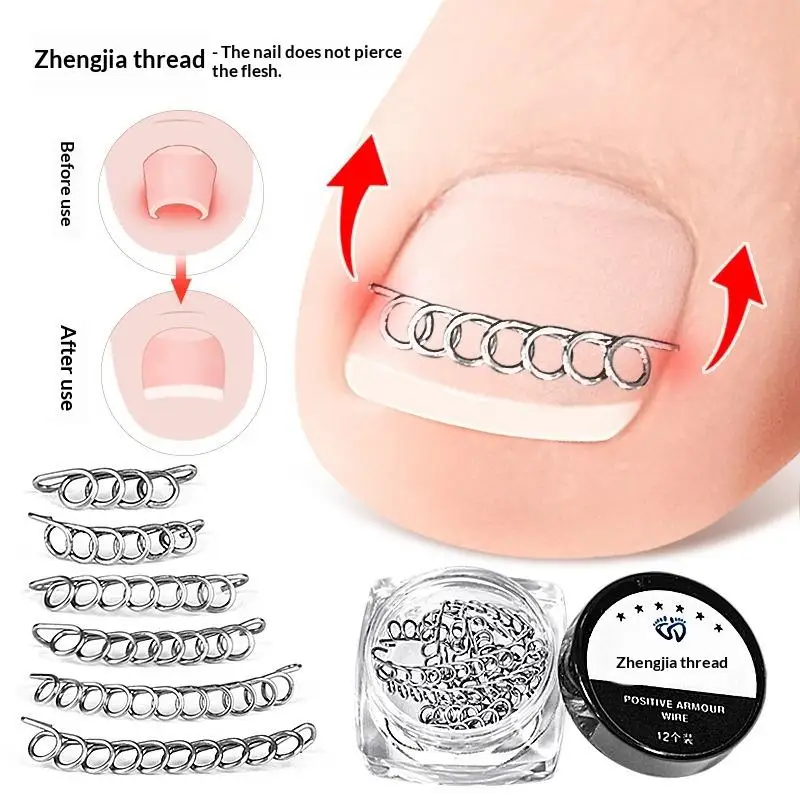 12Pcs / Box Ingrown Toe Nail Corrector Spring Wire Fixer Pedicure Recover Straightening Clip Patch Toenails Orthotic Foot Care