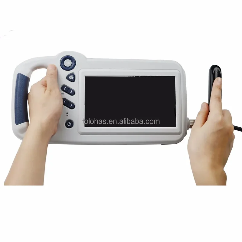 LHWL80 Portable Veterinary Ultrasound Scanner Medical FarmScan Bovine Ultrasound Equipment