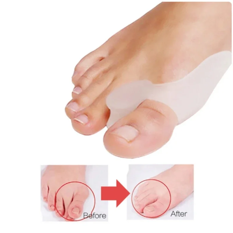 Melon al Soft Elastic Invisible Big Parker, Déformation Parker, Ensemble de soins, Rabat externe, Anti-usure, Amélioration, Rabat interne, Mathiateur