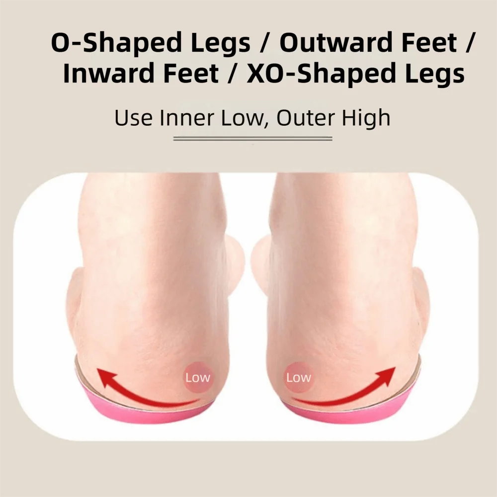 Silicone Gel Orthopedic Insoles Medial Lateral Valgus Varus Correction Alignment Insoles Shock Absorption Arch Support