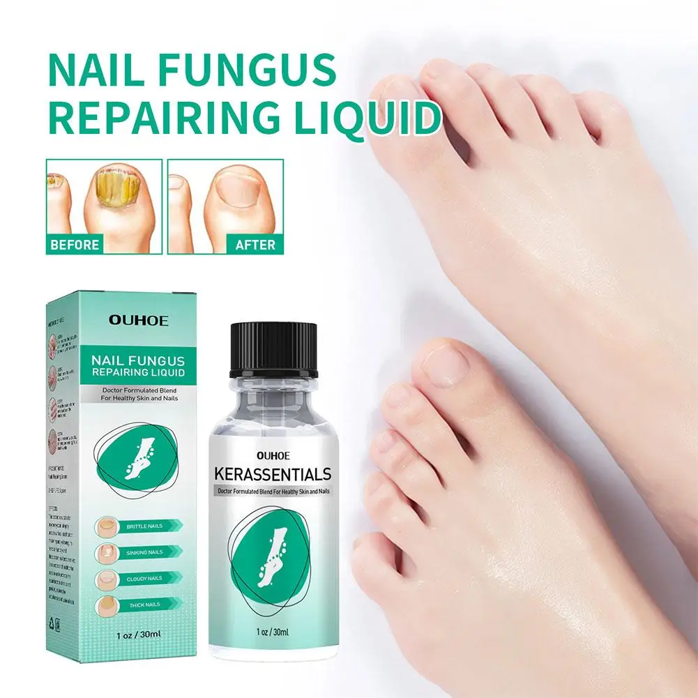 OUHOE 1/3/5PCS Extra Strong Nail Fungus Treatment Serum Essence oil Care Repair Essence Anti Toe Infection Gel Feet Cream
