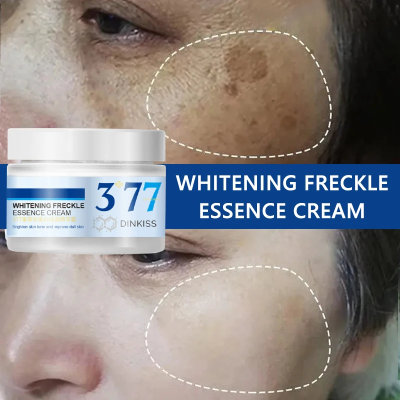 Freckles Cream Remove Melasma Lightening Moisturizing Brightening Uniform Skin Tone Nourishing Beauty Face Skin Care 50g