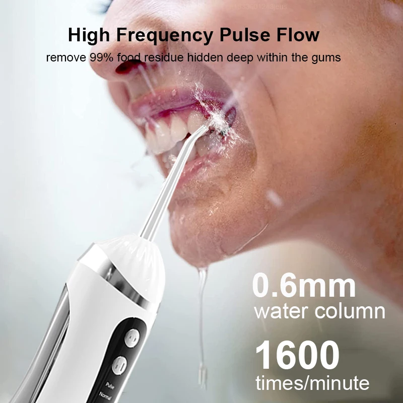 Thumbnail 4 - #7 Top Rated Water Flossers to Buy in 2026