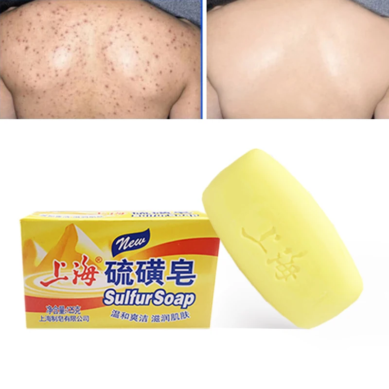 10Pcs original Shang Hai LiuHuang soap 125g/pcs