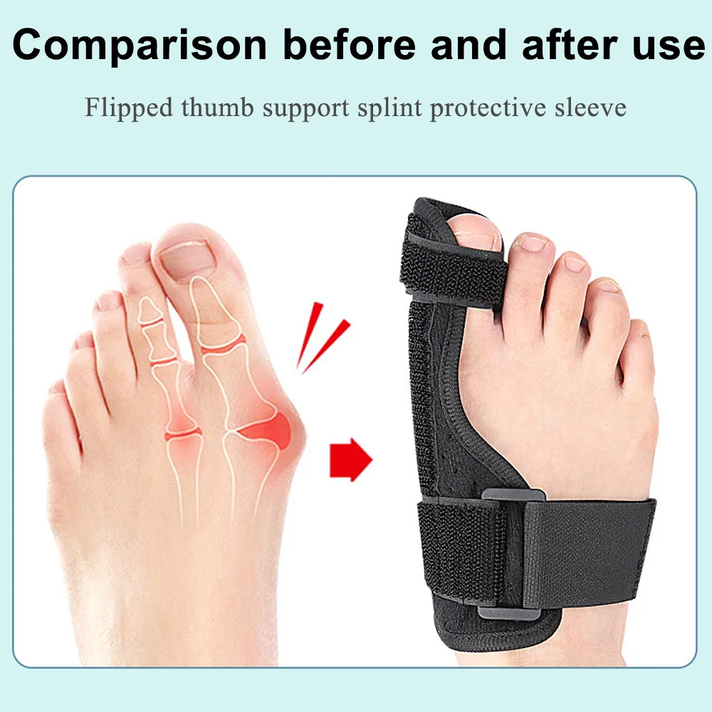 WINRUOCEN Adjustable Hallux Valgus Orthosis: Breathable Bunion Corrector Splint Big Toe Straightener Pain Relief Foot Tool