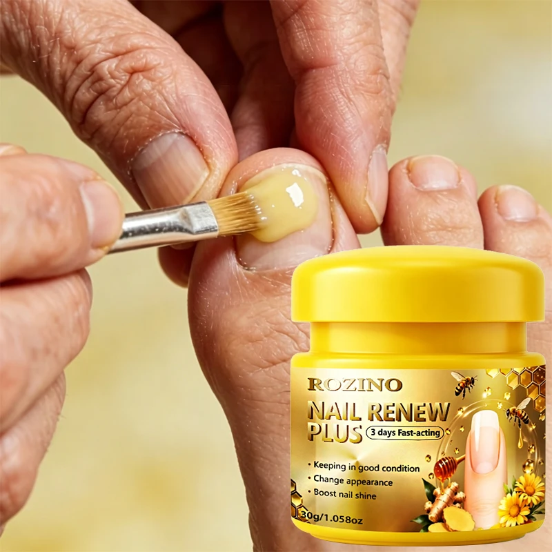 Super Powerful 95% Bee Venom 3-Day Nail Care Cream Plus+, 3-Day Revitalizing Nail Cream, Used for 24-Hour Continuous Care of Discolored, Thickened, and Damaged Nails, Maintains Good Condition, Quickly Effective, Instantly Stops Spread, Maximum Strength - 98% Change in Appearance, Promotes Healthy Nails, Deeply Moisturizes, Smoothes Nails, Enhances Shine, Strengthens Fragile and Easily Broken Nails, Specifically Designed for Revitalizing Discolored, Damaged, and Thickened Nails