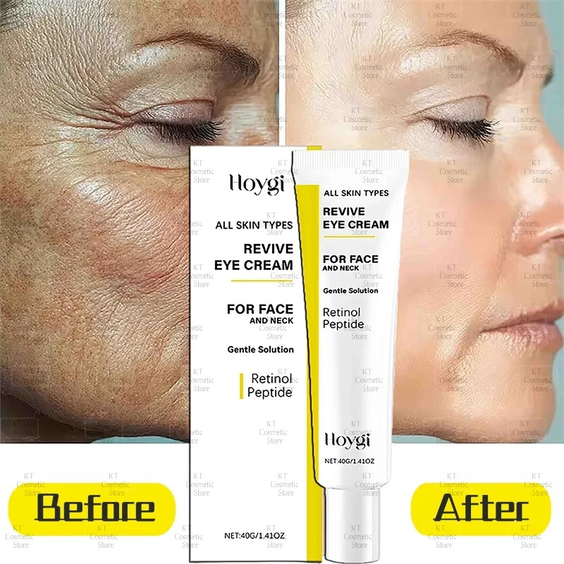 

Revive Eye Cream For Face And Neck Retinol Anti-Wrinkle Eye Bags Puffiness Dark Circles Fine Lines Tighten Eyes Korean Cosmetics