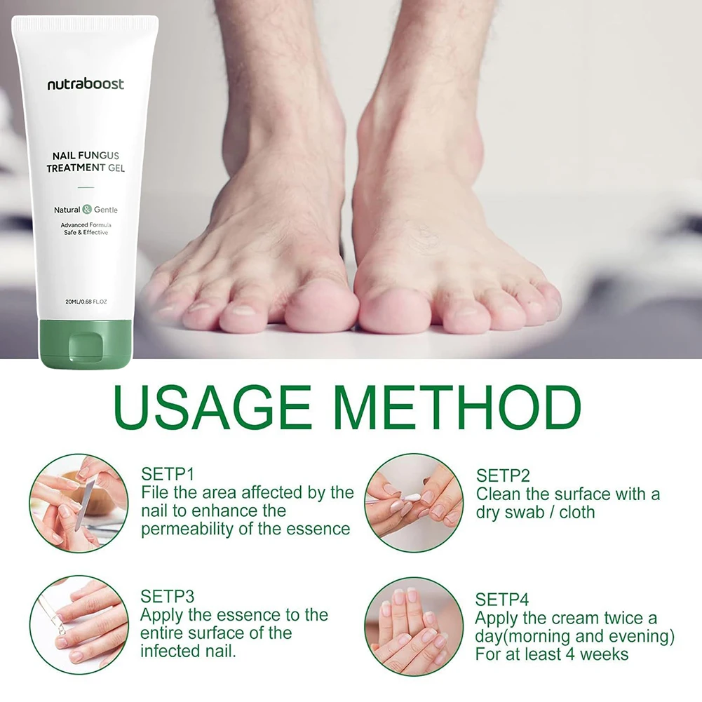 ครีมทามือไม่เหนียวเหนอะหนะบำรุงมือและเท้าเซรั่มดูแลเล็บสำหรับฤดูหนาวเนื้อเจลแห้งดูดซึมง่ายการรักษาเชื้อราที่เล็บ 20 มล