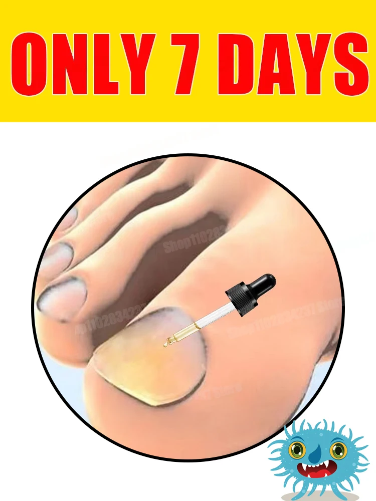 

Омоложение - Технология предотвращения грибка - Регулируемый датчик управления и безопасности 55