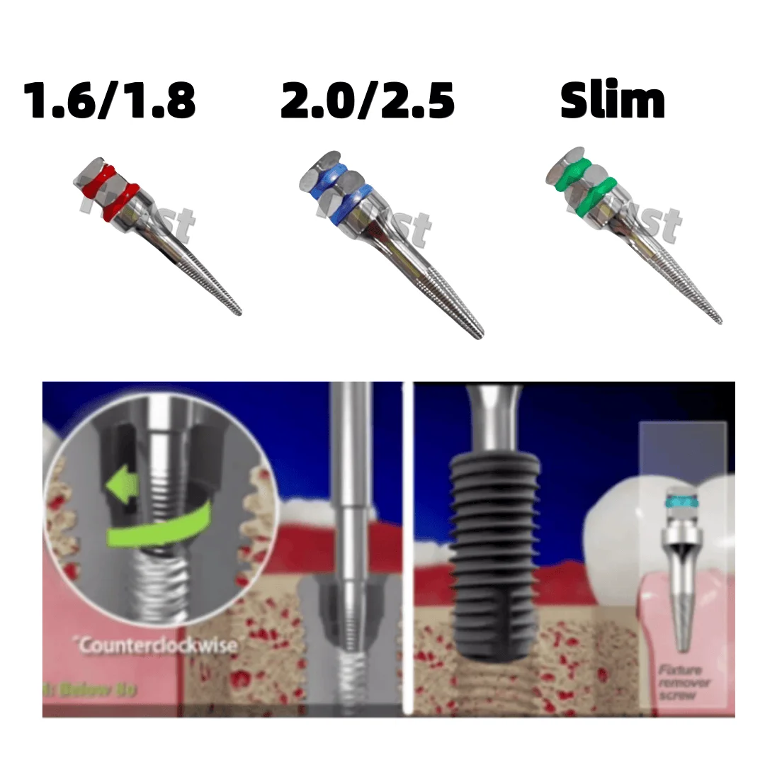 

Dental Broken Implants Pick Up Extractor Failed Fixture Remove SOS Screws High Quality Affordable Price Reliable Tool