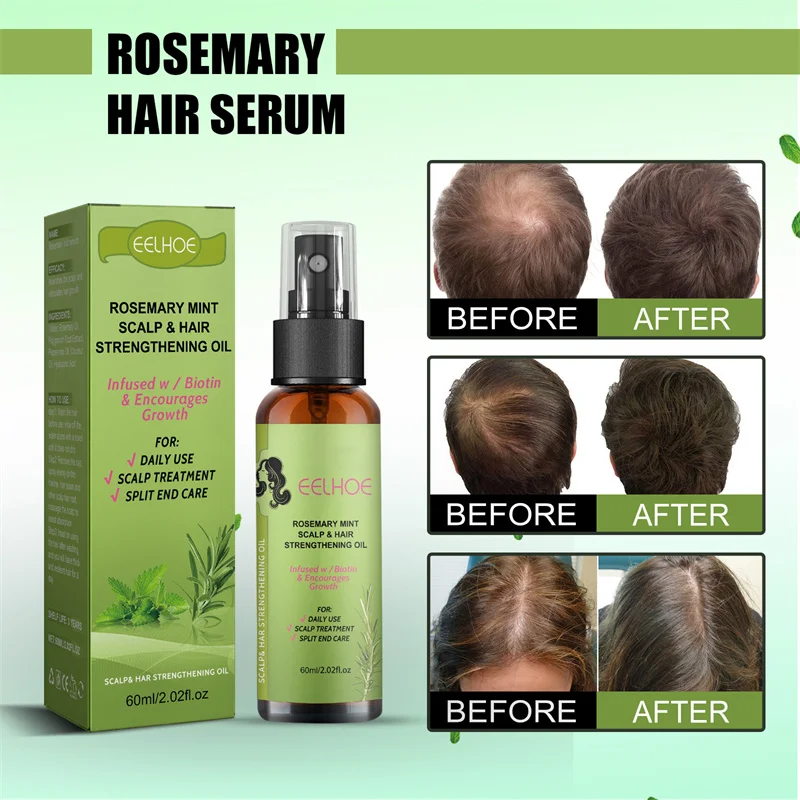 Hair Growth Rosemary Spray Mint Split Ends Dry Nourishing Treatment Hair Mask Bald Strengthening Anti Loss shampoo Essential Oil