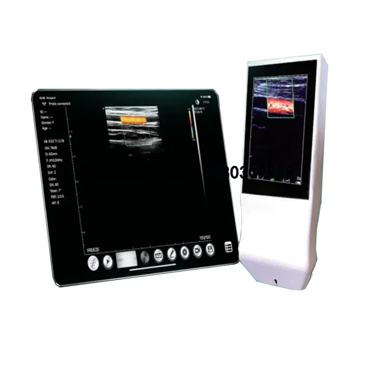 

Wireless Medical Ultrasound Instruments with Touch Screen