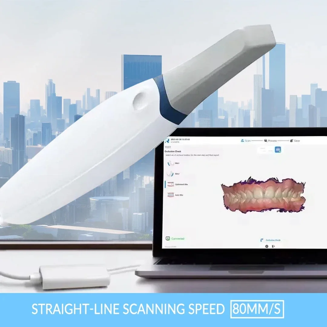 Dental 3D Scanner AI 3.0Pro Cloud Sharing Digital Intraoral Scanner System Digital Impression System Dental Lab Equipment