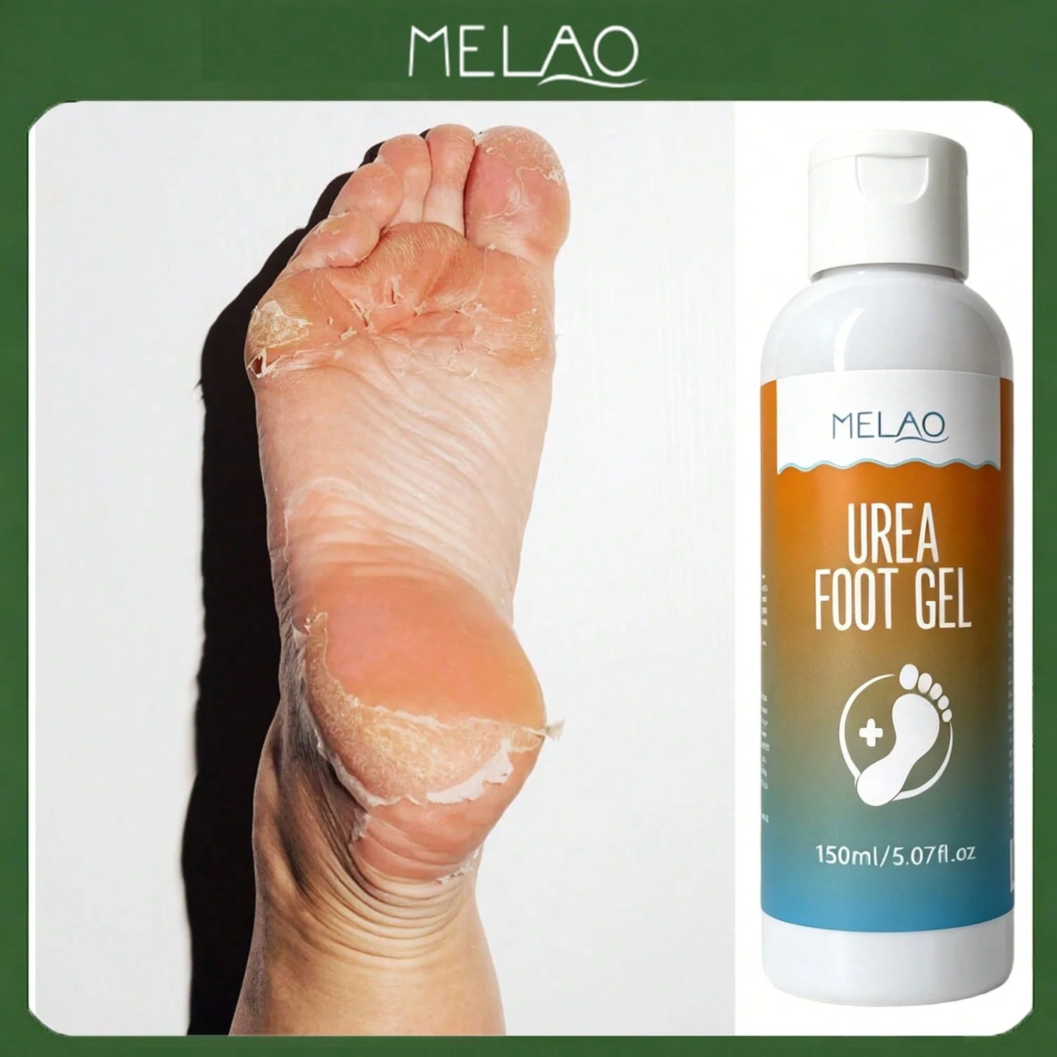 MELAO Urea Foot Exfoliating Gel, Dissolve Dead Skin, Remove Calluses & Repair Cracked Rough Heels, Soften Dry Coarse Feet Skin