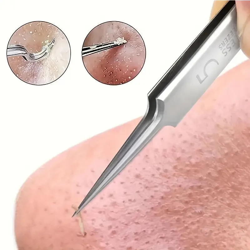 1 paquet extra fin n° 5 pincettes cellulaires pour points noirs d'acné, outils de beauté du visage pour éliminer l'acné, pour les soins de la peau
