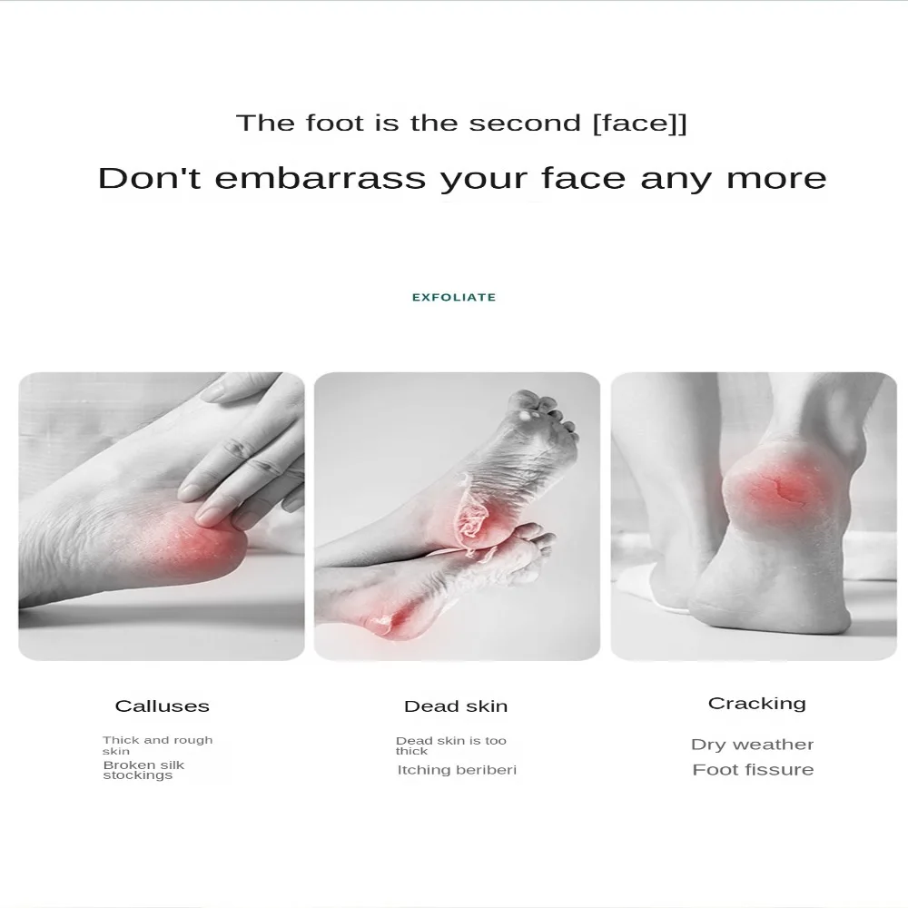 Cura dei piedi principale Rimozione della pelle secca in acciaio inossidabile Rimozione del piede bifacciale Lime per smerigliatrice del piede Rimozione della buccia del callo Pelle morta