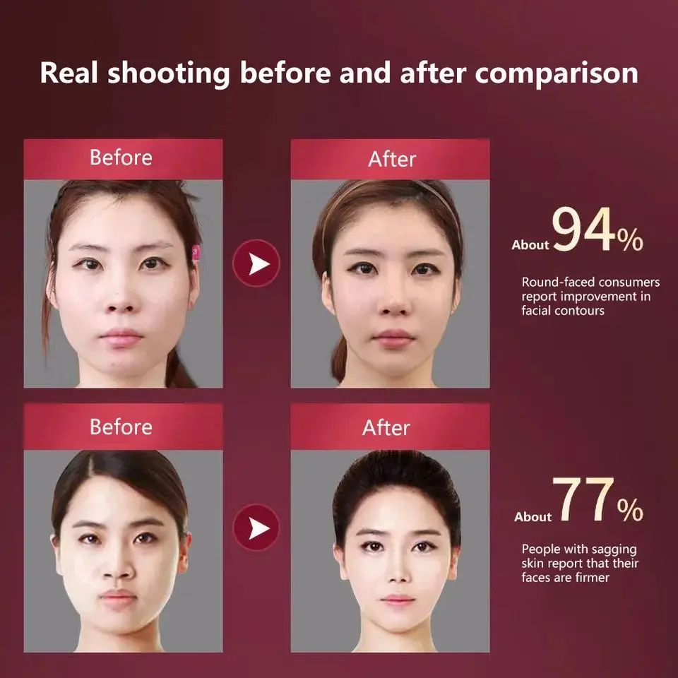 LED الفوتون العلاج الوجه التخسيس مُدلك بالاهتزاز جهاز رفع الوجه الوجه ساخنة مزدوجة الذقن الخامس الوجه مُدلك بالاهتزاز #6