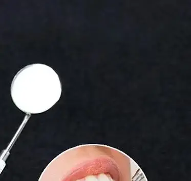 

5/10Pcs Dental Mirrors with Handle Stainless Steel Surgical Instruments Dentist Mouth Checking Makeup Supplies