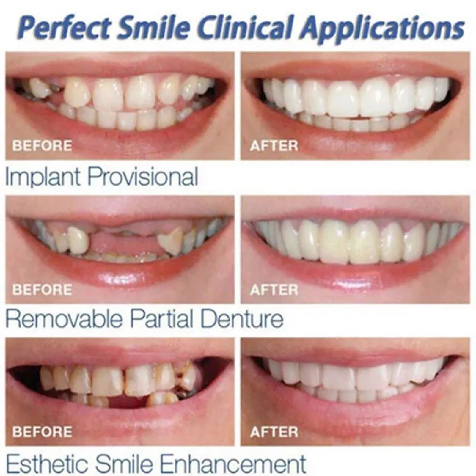 2 pezzi di qualità di seconda generazione Gel di silice materiale temporaneo superiore inferiore dei denti simulazione copertura sbiancante Set falso dente finto